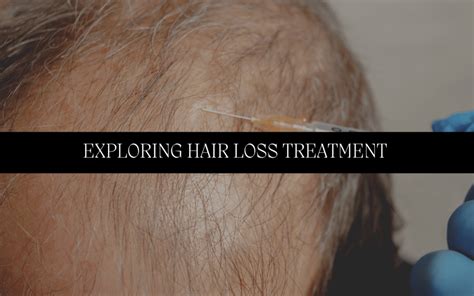 Exploring Hair Loss Treatments Oral Vs Topical Options Kiierr Laser