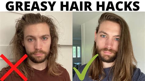 5 Ways To Fight Oily Hair And Scalp Youtube