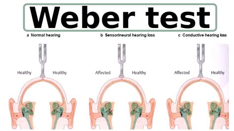 Weber Test Youtube