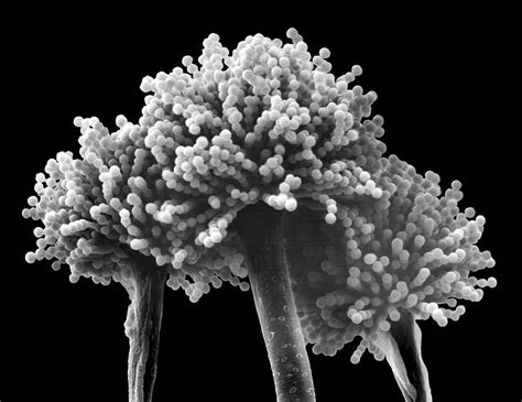 Mould Aspergillus Versicolor Photograph By Dennis Kunkel Microscopy