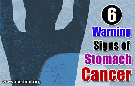 6 Warning Signs Of Stomach Cancer