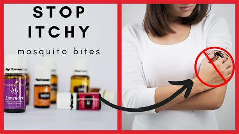 Essential Oils To Stop Mosquito Bites From Itching Youtube