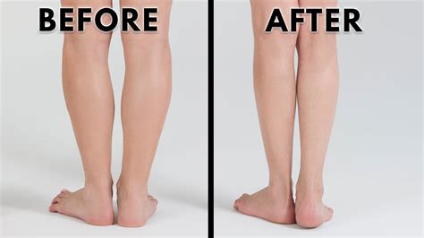 Calf Reduction Exercises Off 65