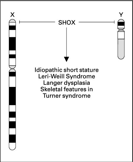 Shox In Short Stature Syndromes Semantic Scholar