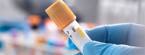 FAQ HIV Testing Patient Education UCSF Health