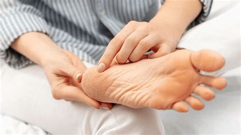 Dermatita De Staz Cauze Simptome Tratament