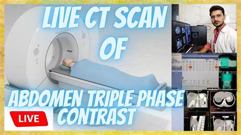 Ct Scan Triple Phase Abdomen Contrast Scanning Process Live Ct Scan