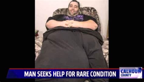 Man Suffering From 100 Pound Testicle Asks The Internet To Help Change