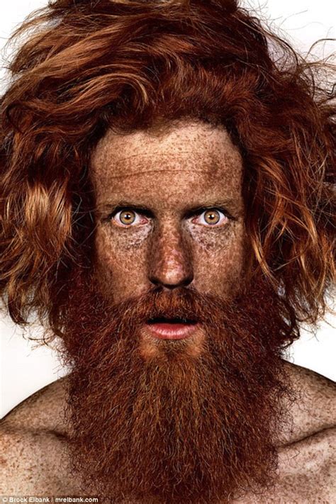 Photographer Brock Elbank Captures Men And Women Covered In Freckles