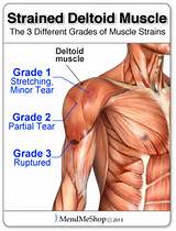 Deltoid Muscle Exercises To Strengthen Images
