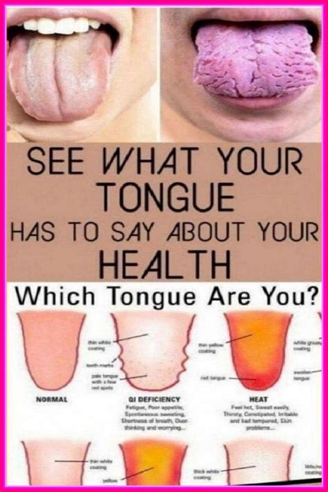 What Does Your Tongue Say About Your Health Pitta Medicine Book