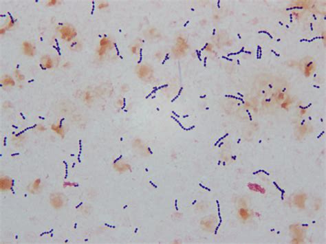 Streptococcus Gram Stain Morphology