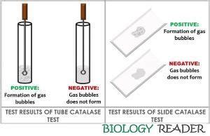 What Is Catalase Test Definition Overview Principle Procedure