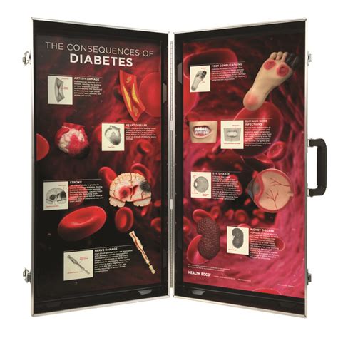 Diabetes Consequences 3 D Educational Display Health Edco