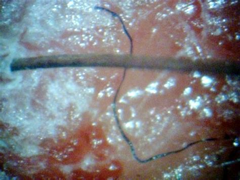 Read his summary paper morgellons: CHEMTRAILS AND MORGELLONS - IT'S WORSE THAN YOU THOUGHT ...