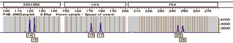 Fbi — Figure 4 Panel 4 Enlarged Stouder Et Al Forensic Science