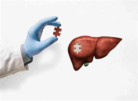 Medanta Types Of Liver Transplant
