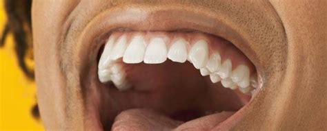 The energy of full moons brings detail for leos. How Smoking Affects the Mouth | myVMC