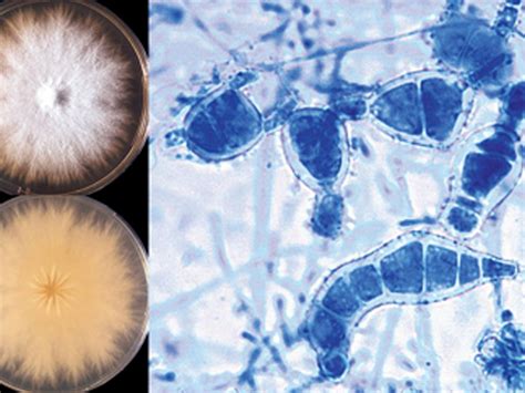 Microsporum Mycology University Of Adelaide