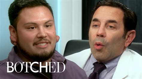 Botched Patients Shock Doctors Paul Nassif Terry Dubrow E Youtube
