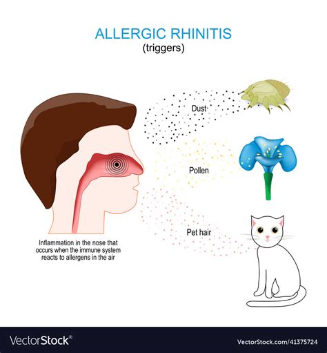 Allergic Rhinitis Triggers Royalty Free Vector Image