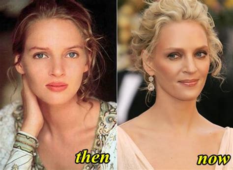 Uma Thurman Plastic Surgery Before And After Photos