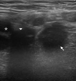 A Woman With Abdominal Pain Annals Of Emergency Medicine