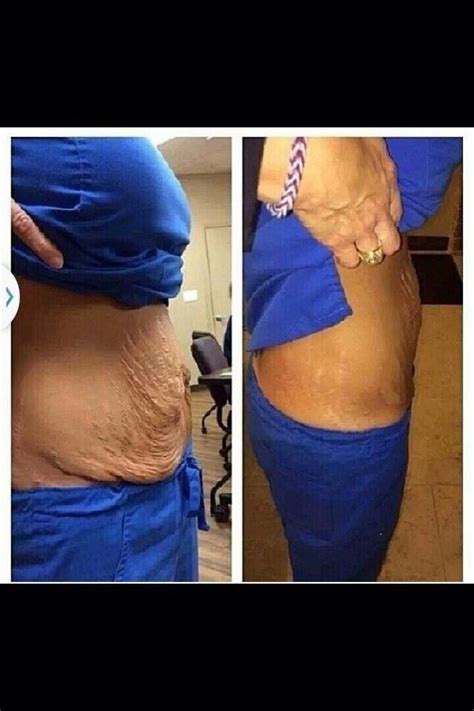 I Am Asked All The Time And The Answer Is Yes Our Wraps Tone Tighten And Firm Loose Skin
