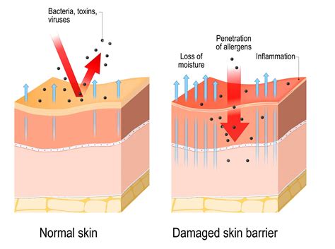 Skin Barrier Repair Get Healthy Skin With Support From Skincare Experts