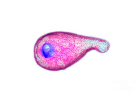Mycoplasma Genitalium Bacterium Photograph By National Infection