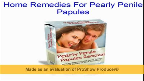 Pearly Penile Papules Removal Free Download Youtube