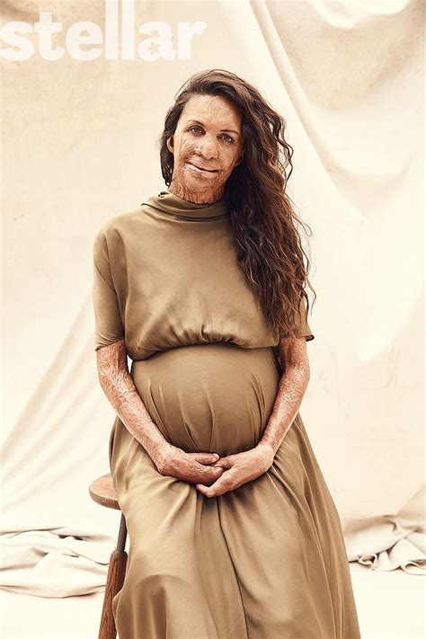 Turia Pitt Reveals The Emotional Toll The Bushfire Crisis Took On Her Daily Mail Online