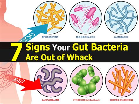 7 Signs Your Gut Bacteria Are Out Of Whack