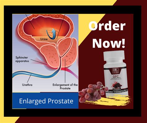 High levels of dht are linked with decreased prostate function and health. Dr.Vita OPC Grapeseed By: Mon PH - Home | Facebook