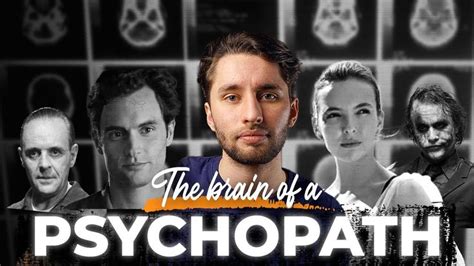 Psychopaths Have Different Brains Heres How In 2022 Psychopath