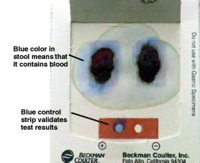 Doctors order blood tests for a variety of reasons. Diagnostic Tools: Hemoccult Card Test