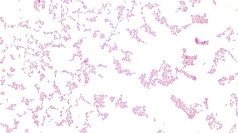Micrograph Escherichia Coli H Endospore X P OER Commons