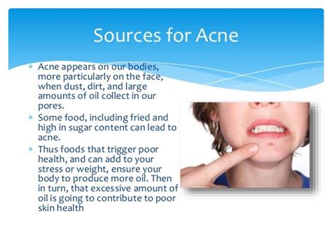 How To Use Paleo Diet For Acne Treatment