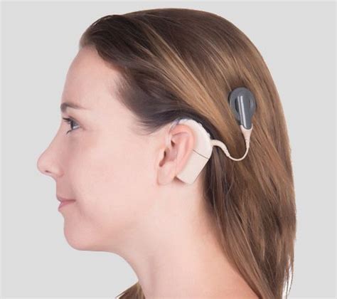 Cochlea Implantat Hörprothese Für Gehörlose Kinder Und Erwachsene