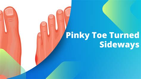 Pinky Toe Turned Sideways Causes And Some Possible Treatments Explained
