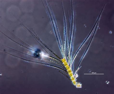 Diatoms Protists