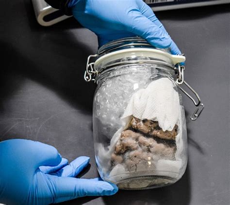 Human Brain Inside Of A Jar Seized By Us Customs In Michigan