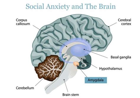 Anxiety Disorder Plp Solutions