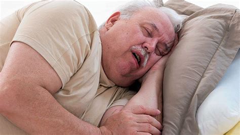 La Apnea Del Sueño Es Un Trastorno Grave Para Los Pacientes Obesos