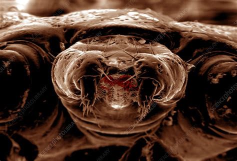 Tick Mouthparts Sem Stock Image C0041584 Science Photo Library