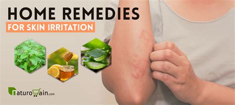 9 Outstanding Home Remedies For Skin Irritation And Redness