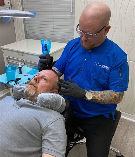 Scalp Micropigmentation For Thinning Hair Tampa