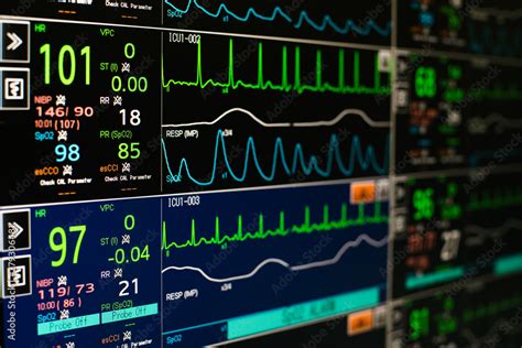 Modern Vital Signs Monitor Display At Icu In Hospital Stock Photo