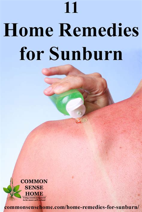 11 Home Remedies For Sunburn Relief Get Rid Of Sunburn