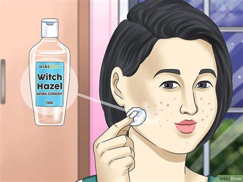 How To Get Rid Of A Zit Overnight Expert Approved At Home Remedies